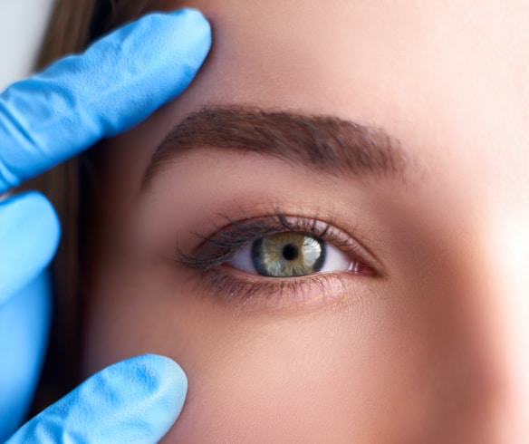 Eyelid Surgery