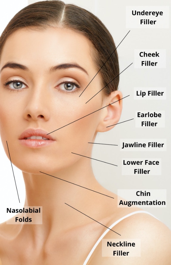 dermal filler