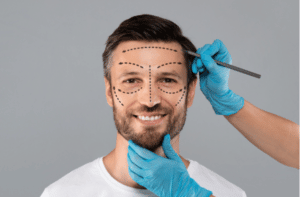 Surgeon hands making marks on smiling man face.