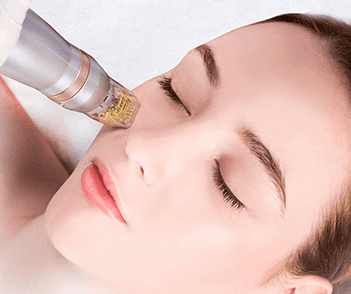 Microneedling with Exosomes