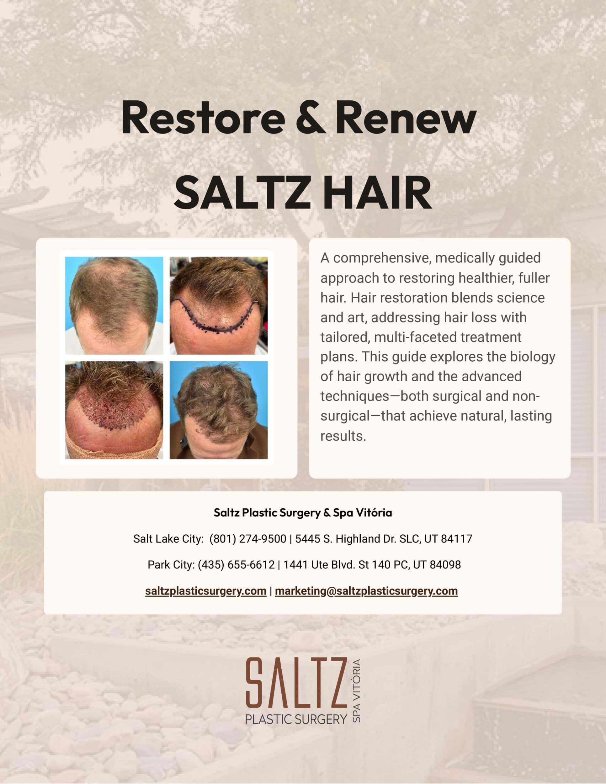 A Smarter Approach to Hair Restoration