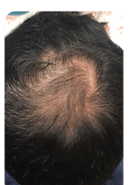 After Image: Breeze Before and After - back