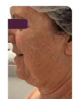 Before Image: WonderTouch Before and After - left-side