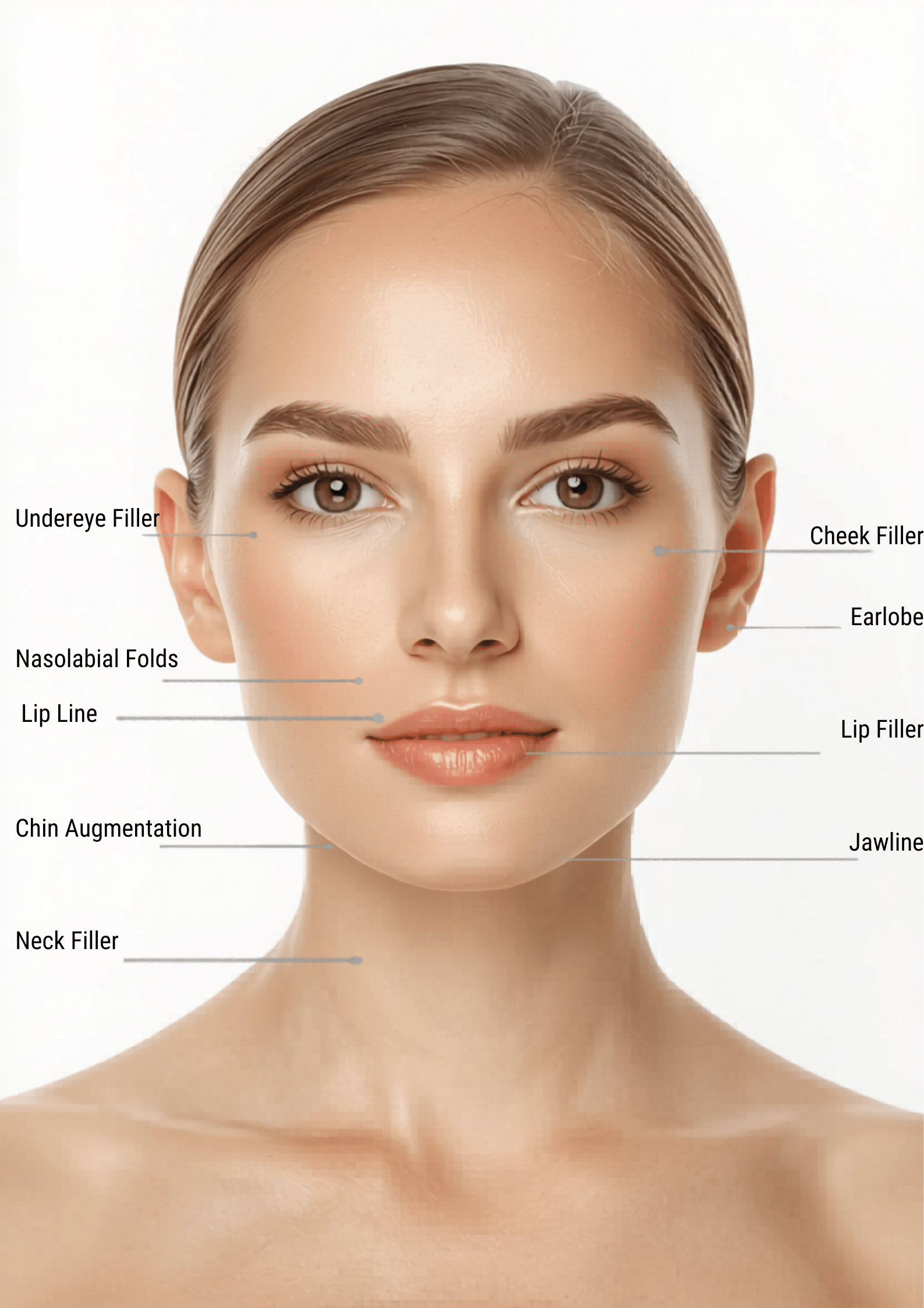 Dermal Filler Areas