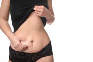Woman with loose skin on midsection in need of tummy tuck or liposuction in Salt Lake City, UT