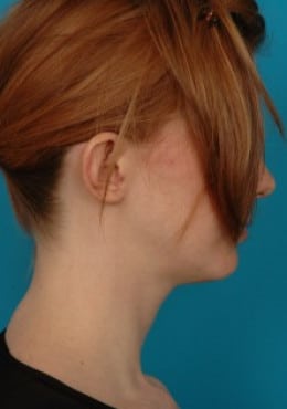 Before Image