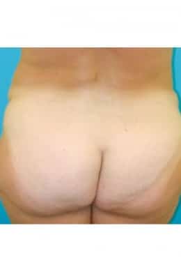 After Image