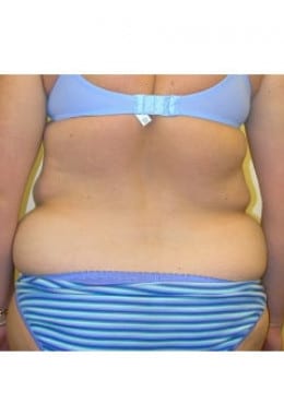 Before Image