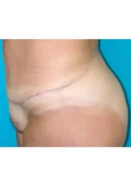 After Image